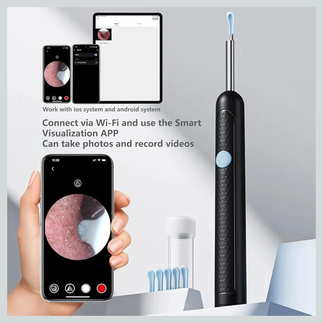 Ear Wax Removal Kit with Camera